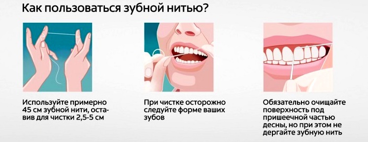 Чистить зубной нитью до или после