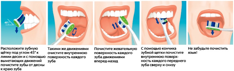 Как правильно чистить зубы