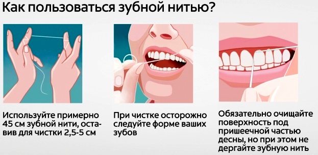 Как использовать зубную нить